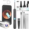 image:imageBEBIRD Ear Wax Removal Tool with HD Camera  R1 Upgraded Smart Visual Ear Cleaner with Otoscope Ear Viewer with 6 LED Light amp Multi Replacement Tips for Cleaning Earwax amp Inspection Kits