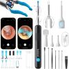 image:imageBEBIRD R1 Ultra Ear Wax Removal Ear Cleaner with Camera Ear Scope Wax Remove Ear Pick with Ear Otoscope Tweezers Visual Dropper Cleaning Kit EarNoseThroat Examination Tool for Family